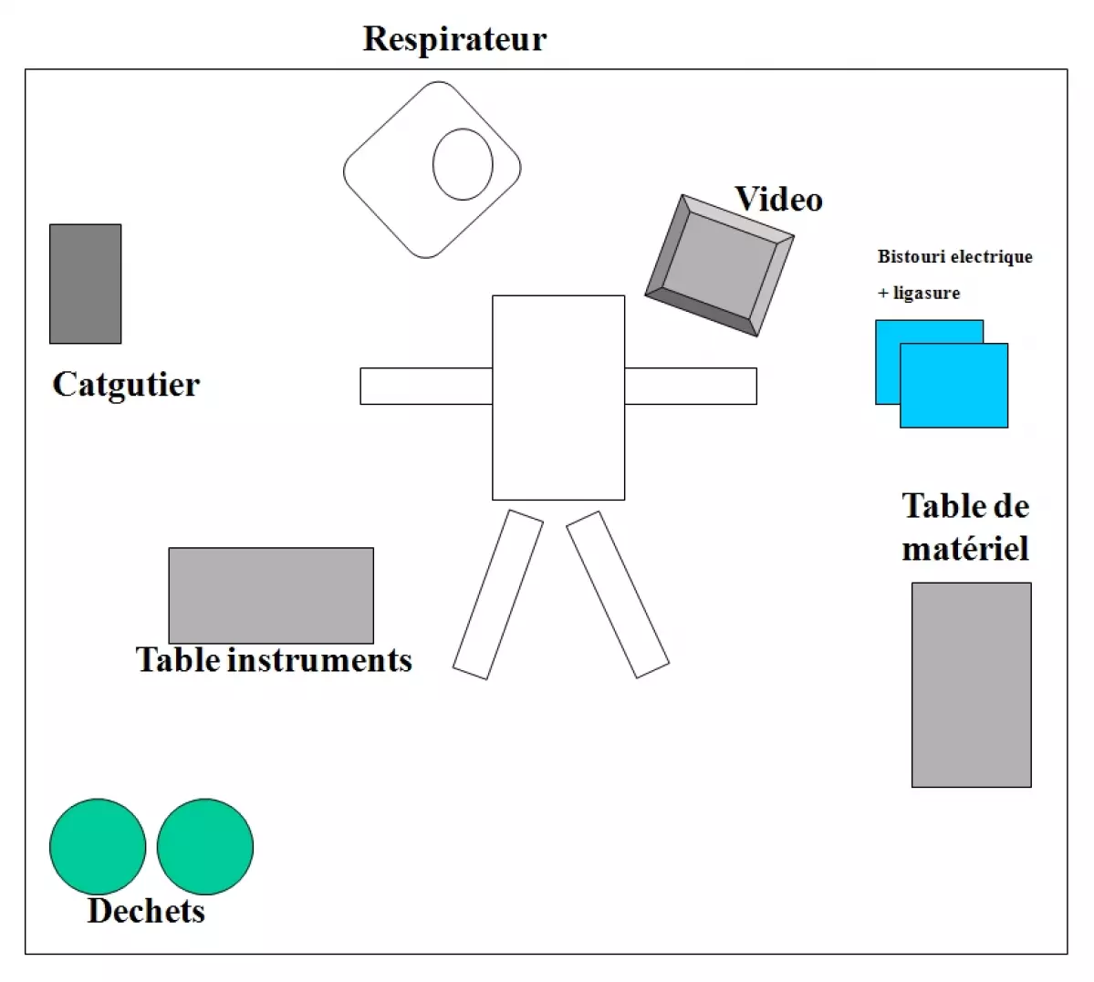 Sleeve gastrectomie