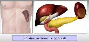 Splénectomie