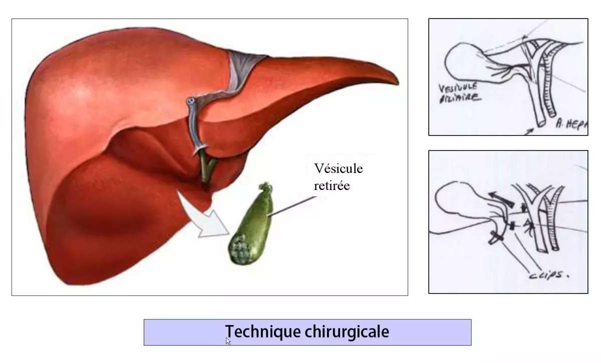 ABCD Chirurgie au congrès de la FCVD