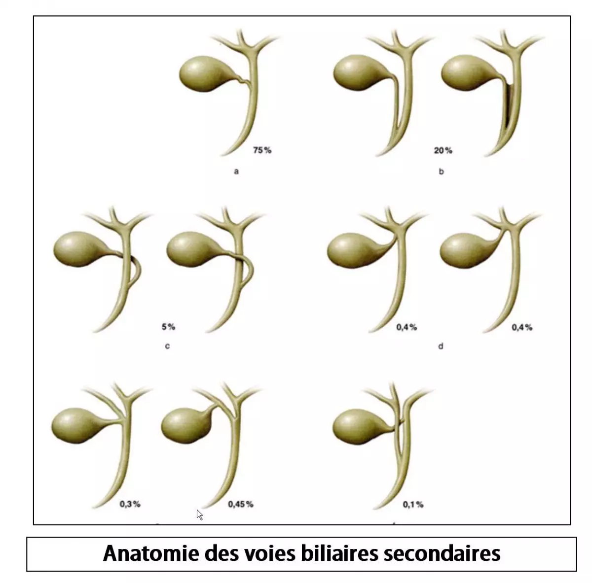 variantes VB