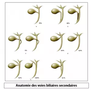 variantes VB