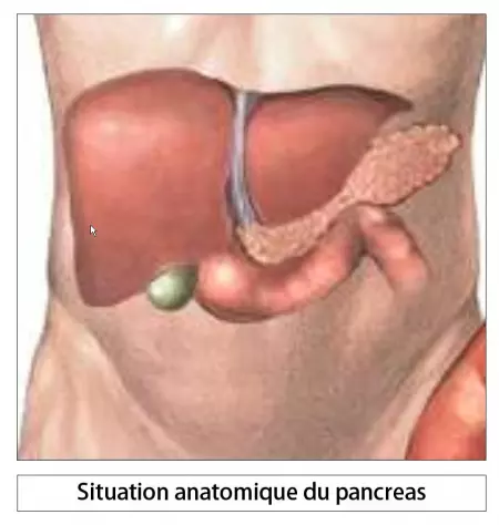 Splénopancréatectomie gauche