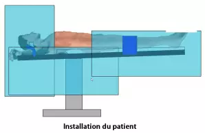 Eventration sous coelioscopie