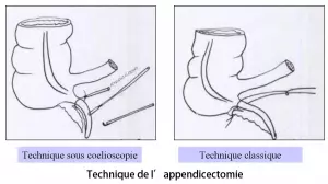 App 3
