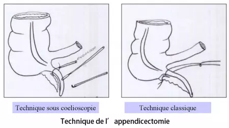 App 3