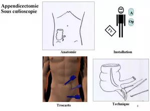 App 4