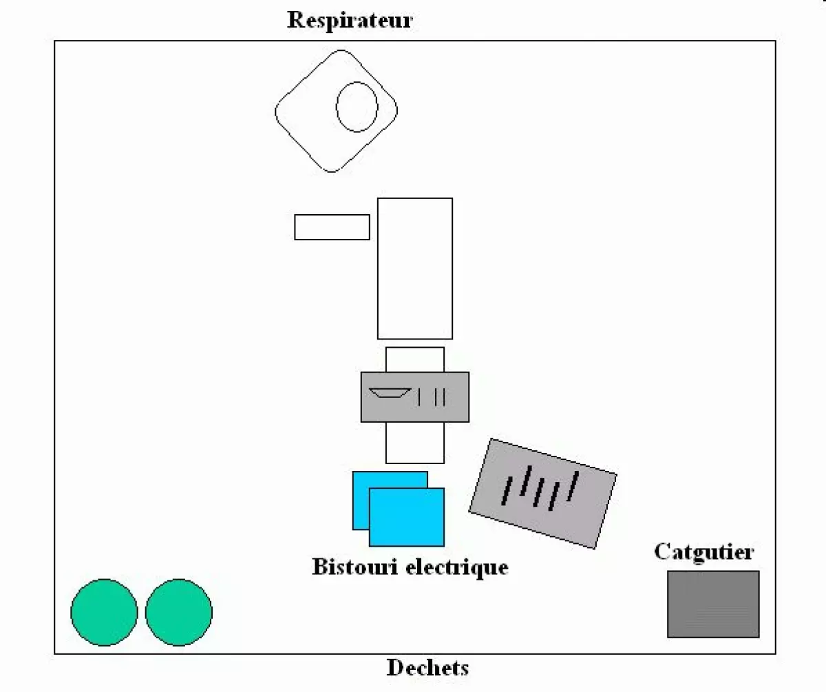 Ablation de l'oesophage ou oesophagectomie - IBODE