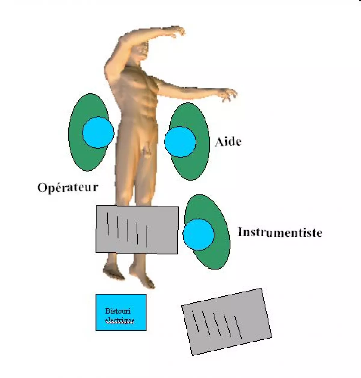 anastomose_portocave-03 - IBODE