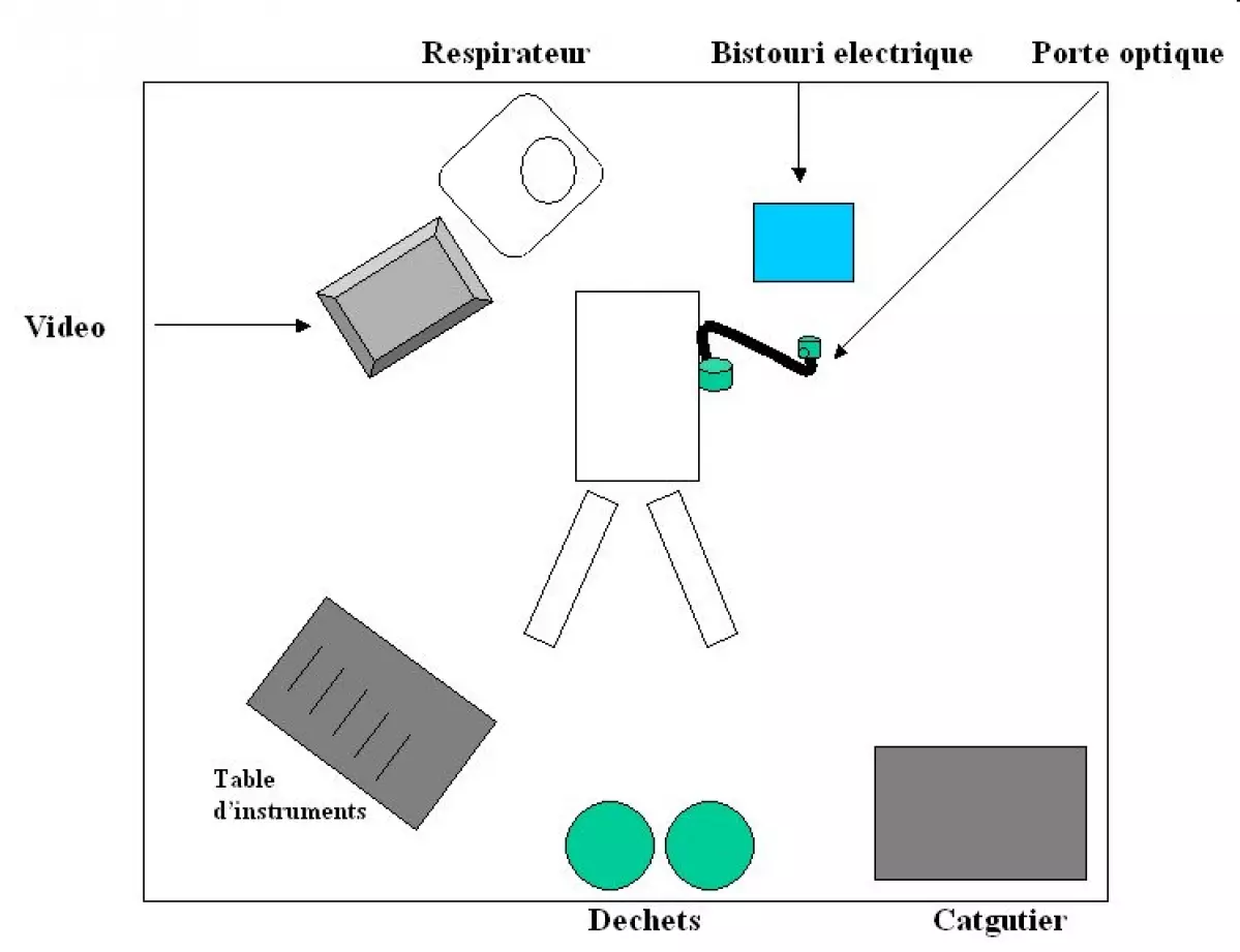 Anastomose bilio-digestive - IBODE