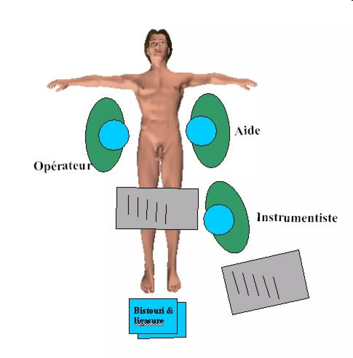 gastrectomie_totale-03 - IBODE