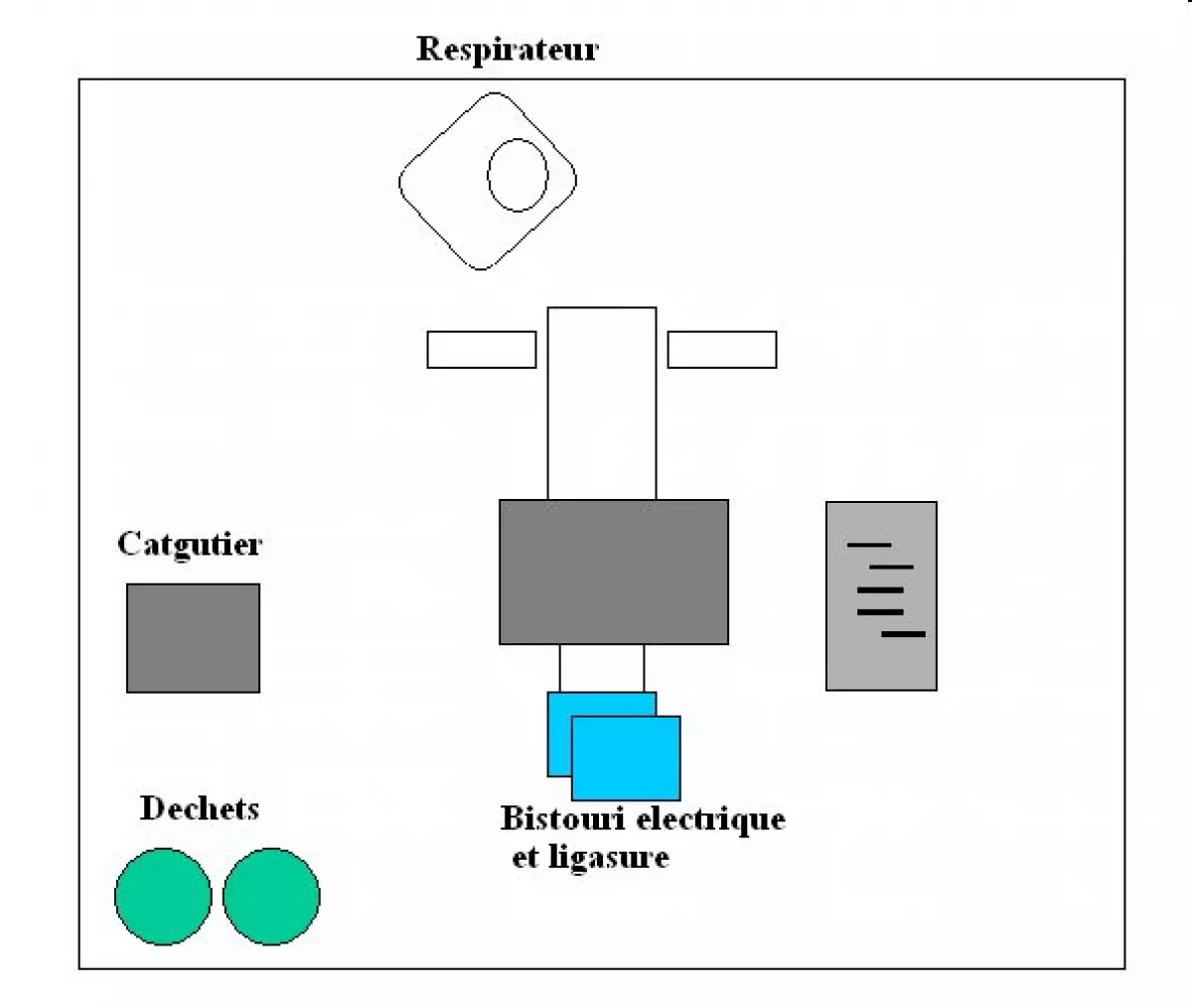 Duodenopancreatectomie céphalique - IBODE