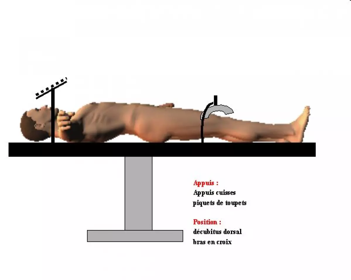 Chirurgie du pancréas et de la rate -IBODE