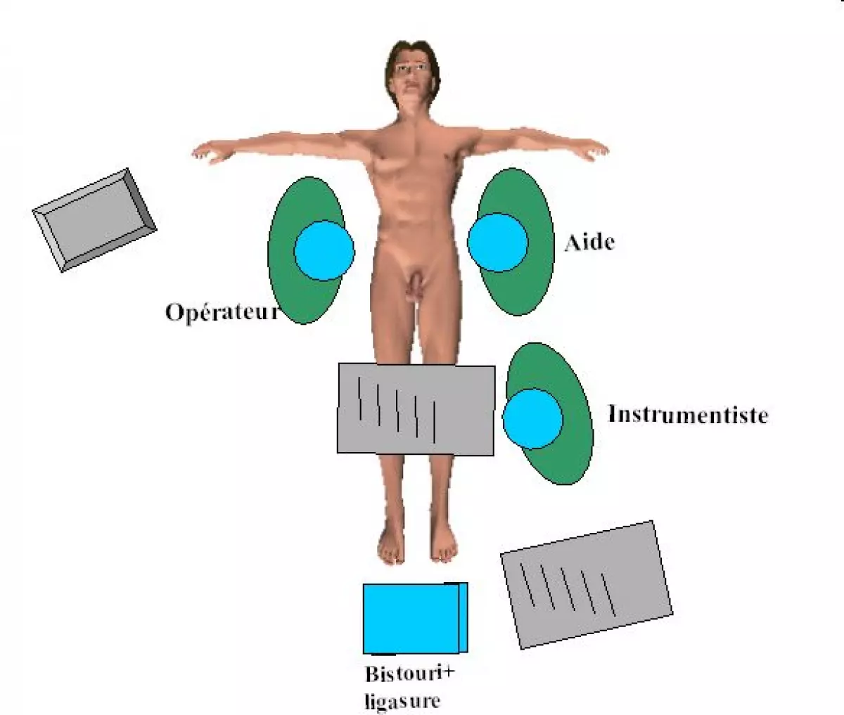 duodenopancreatectomie_cephalique-03 - IBODE
