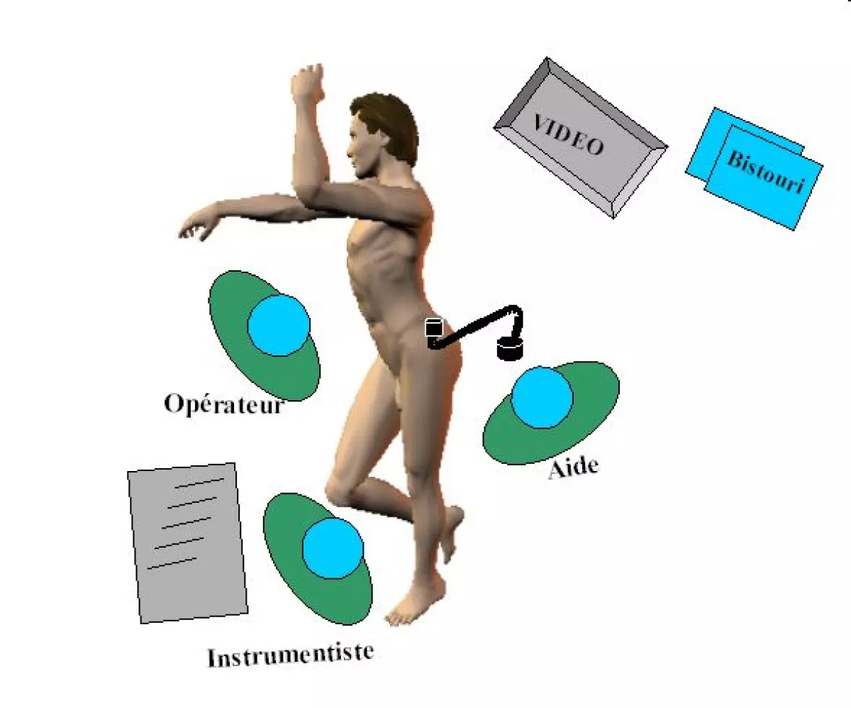 Splenectomie-03 - IBODE
