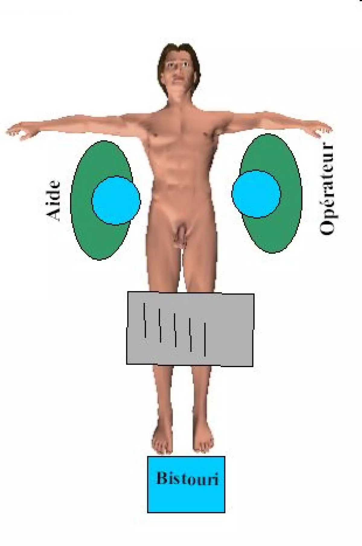 fermeture_stomie-03 - IBODE