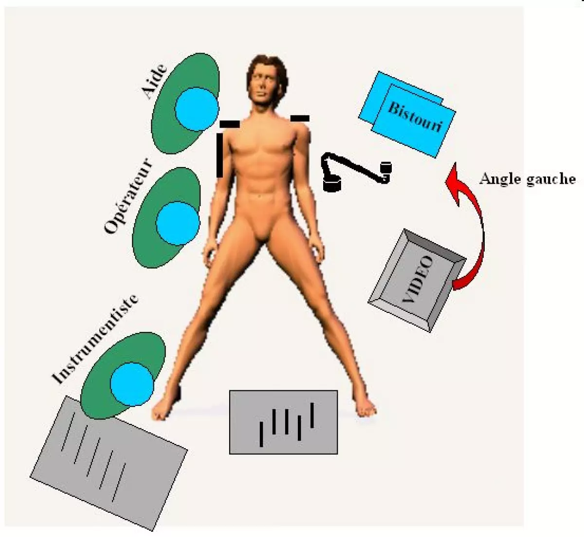 resection_anterieure-03 - IBODE