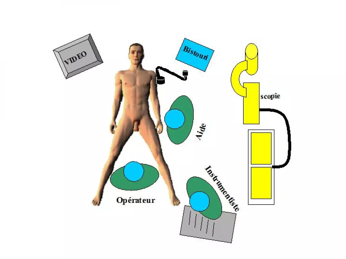 position de l'équipe ibode