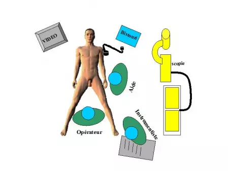 position de l'équipe ibode