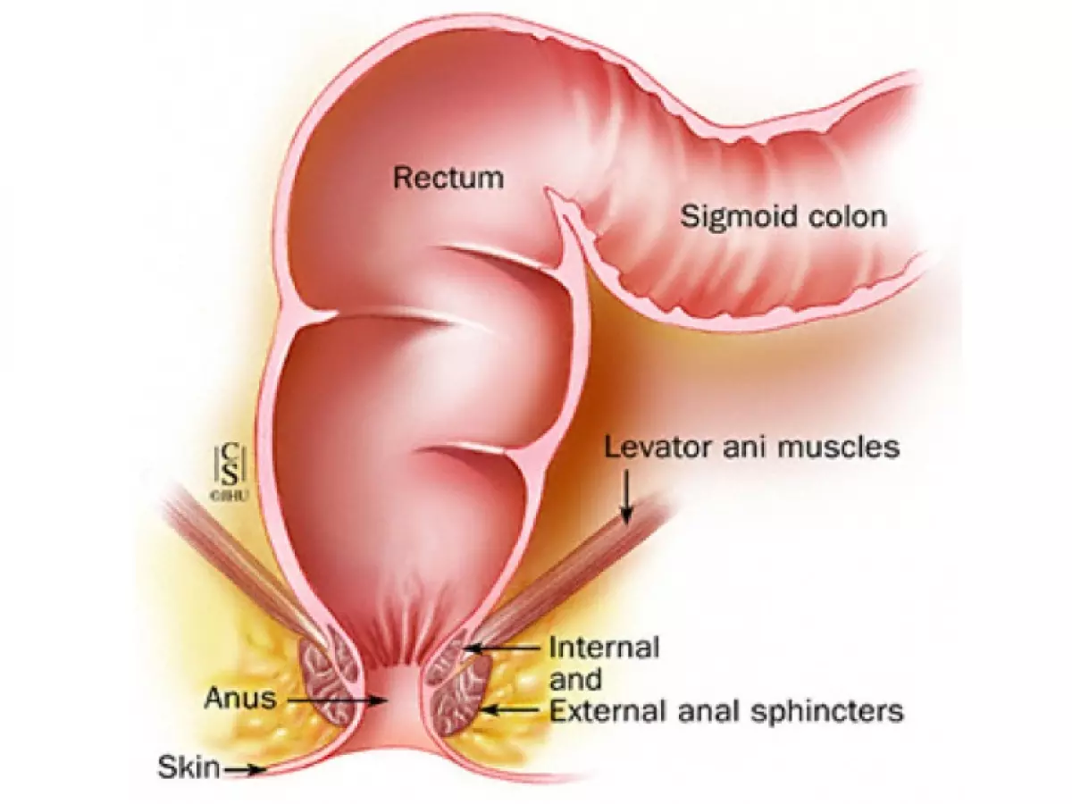 Chirurgie du rectum et de l'anus