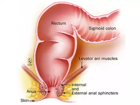 Chirurgie du rectum et de l'anus