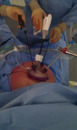 Chirurgie sans cicatrice...visible
