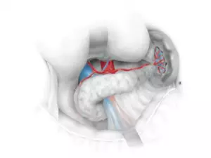 Chirurgie du pancréas et de la rate
