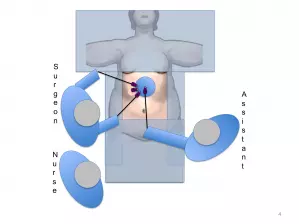 Installation pour chirurgie de l'obésité