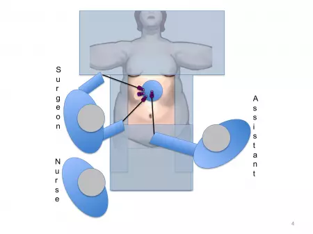 Installation pour chirurgie de l'obésité