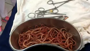 Parasitose intestinale