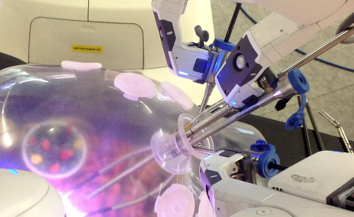 Mini Invasive Single Site Surgery (MISSS)