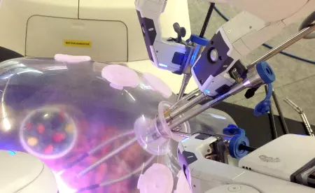 Mini Invasive Single Site Surgery (MISSS)