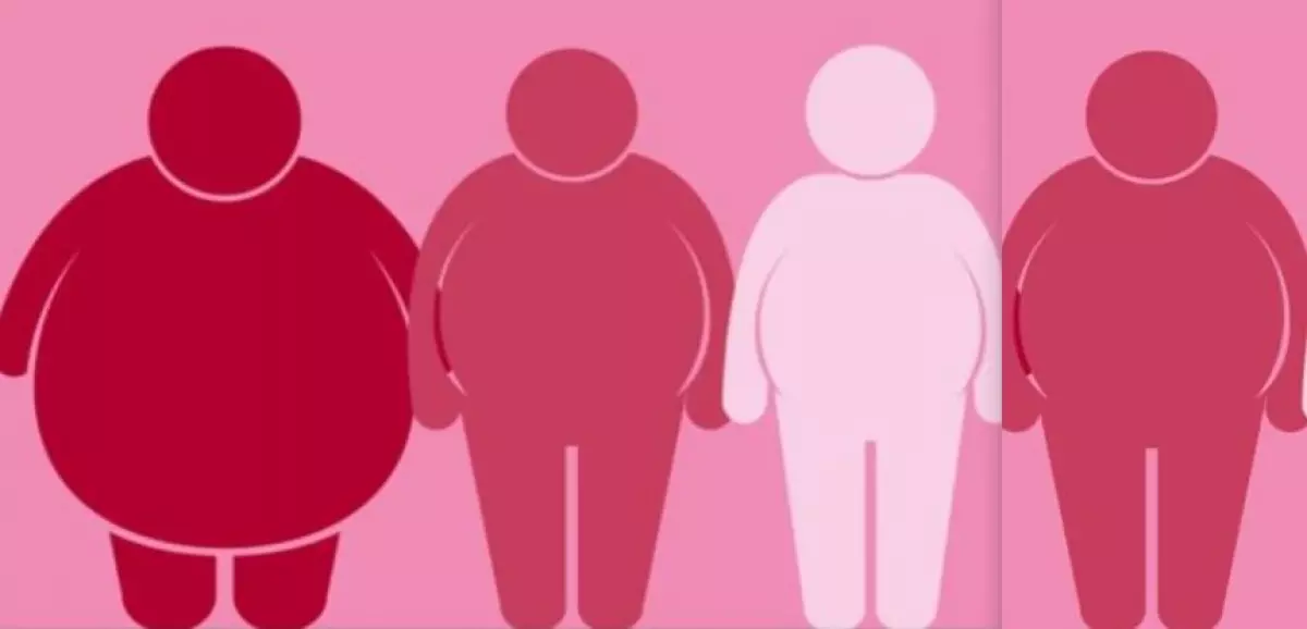 Echec d'une première chirurgie de l'obésité : que faire ?