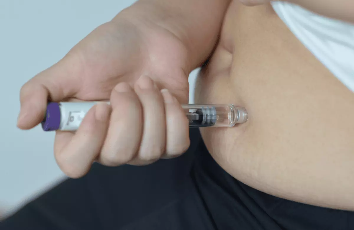 Analogues du GLP-1 après sleeve gastrectomie :