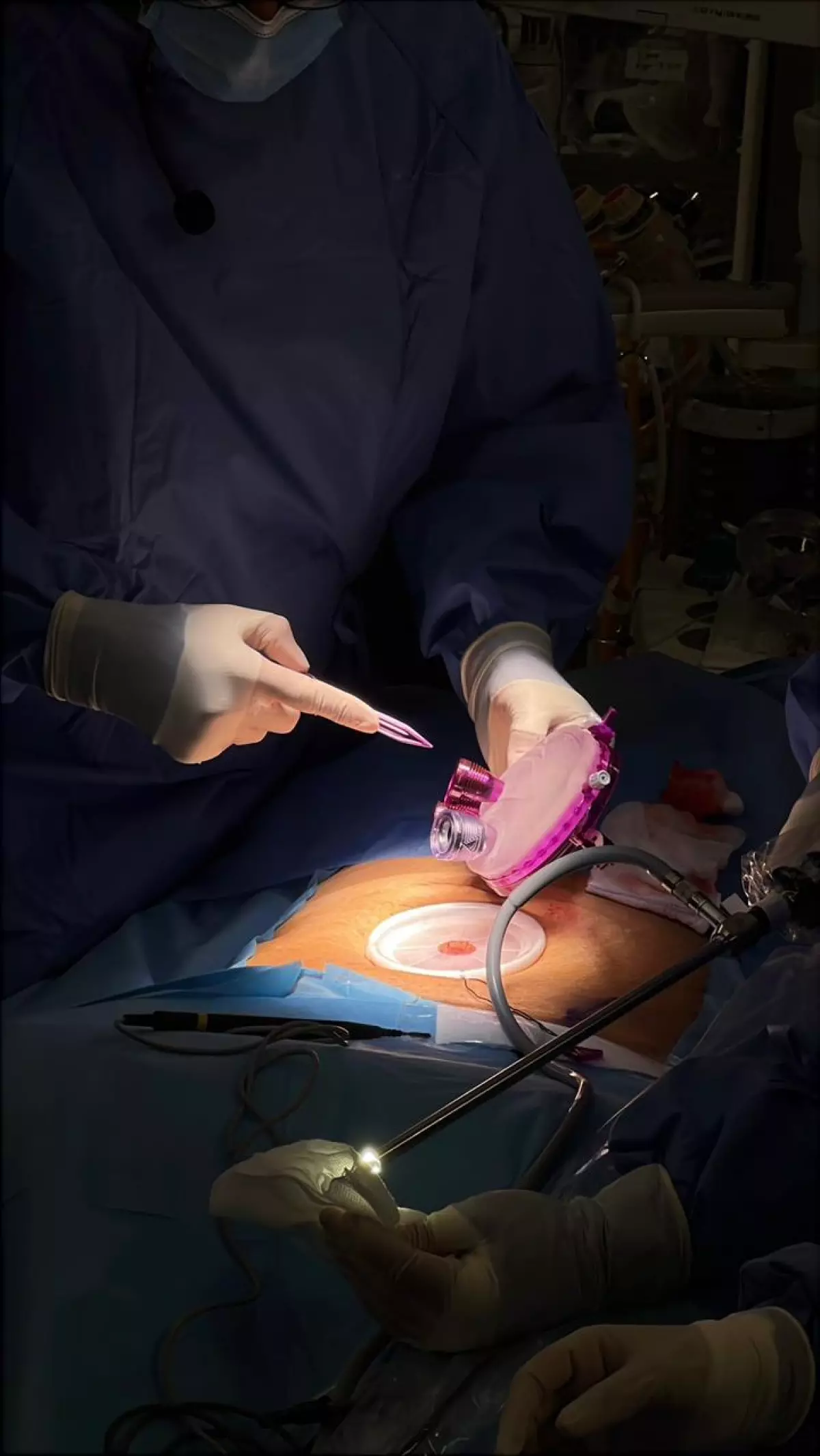 Cours avancé de chirurgie -Single Port- au Koweit